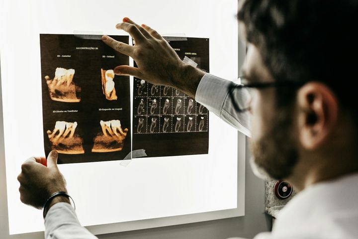 Képalkotó vizsgálat áttekintése implantológiai tervezéshez
